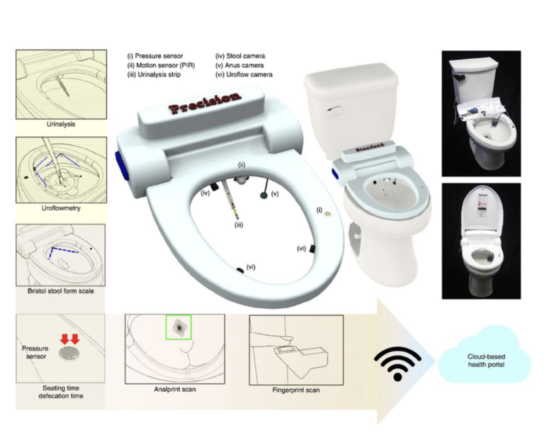 Smart toilet detects disease by analprint