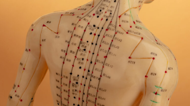 acupuncture-points